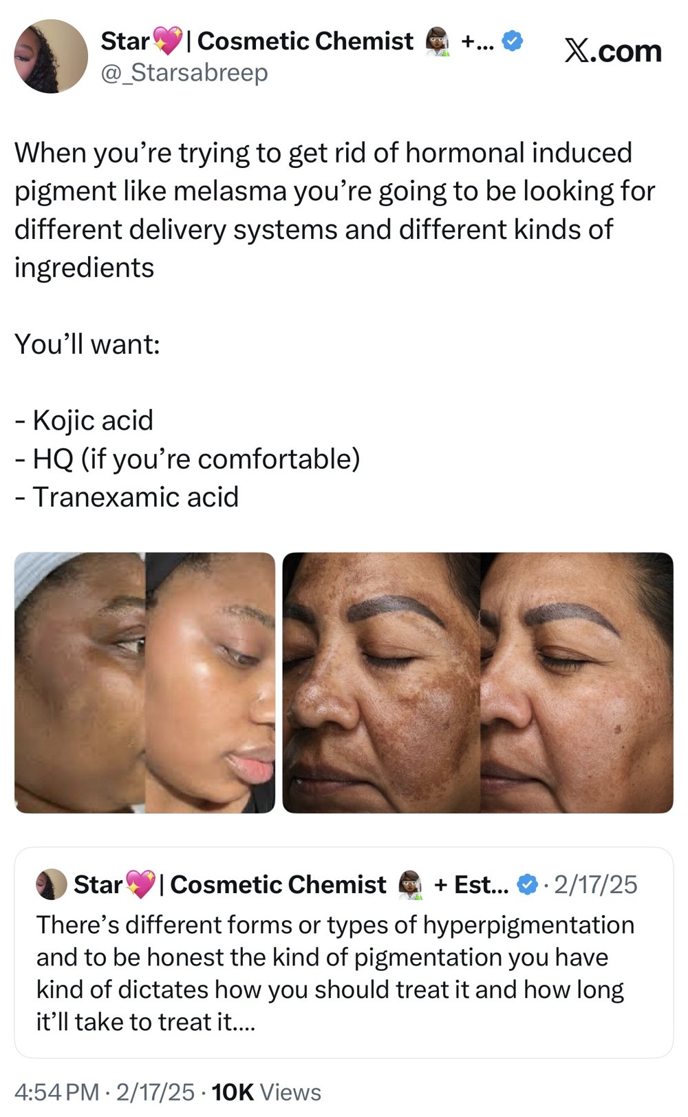 Founder post on treating hormonally induced pigment like melasma